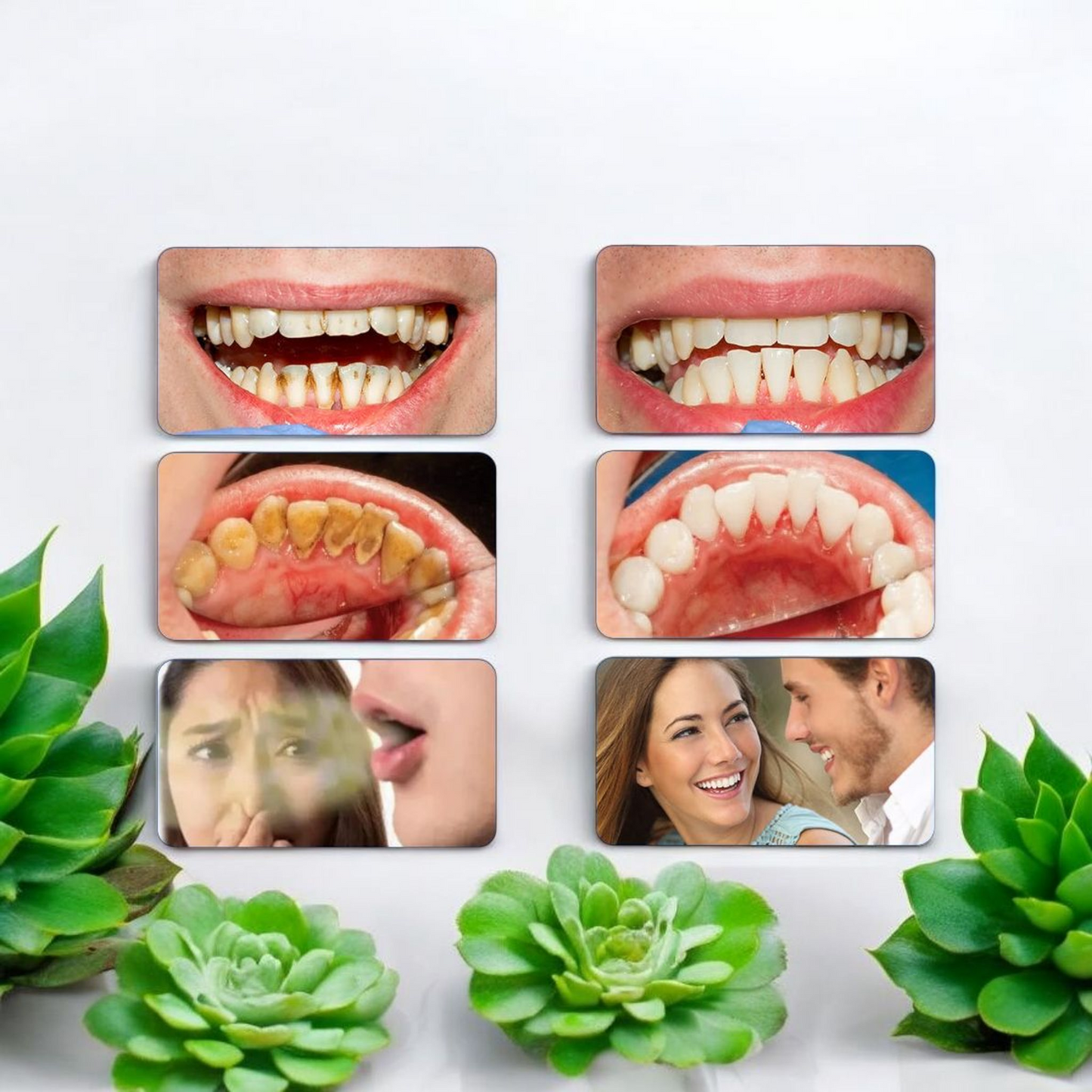 Raspador dental ultrasónico recargable