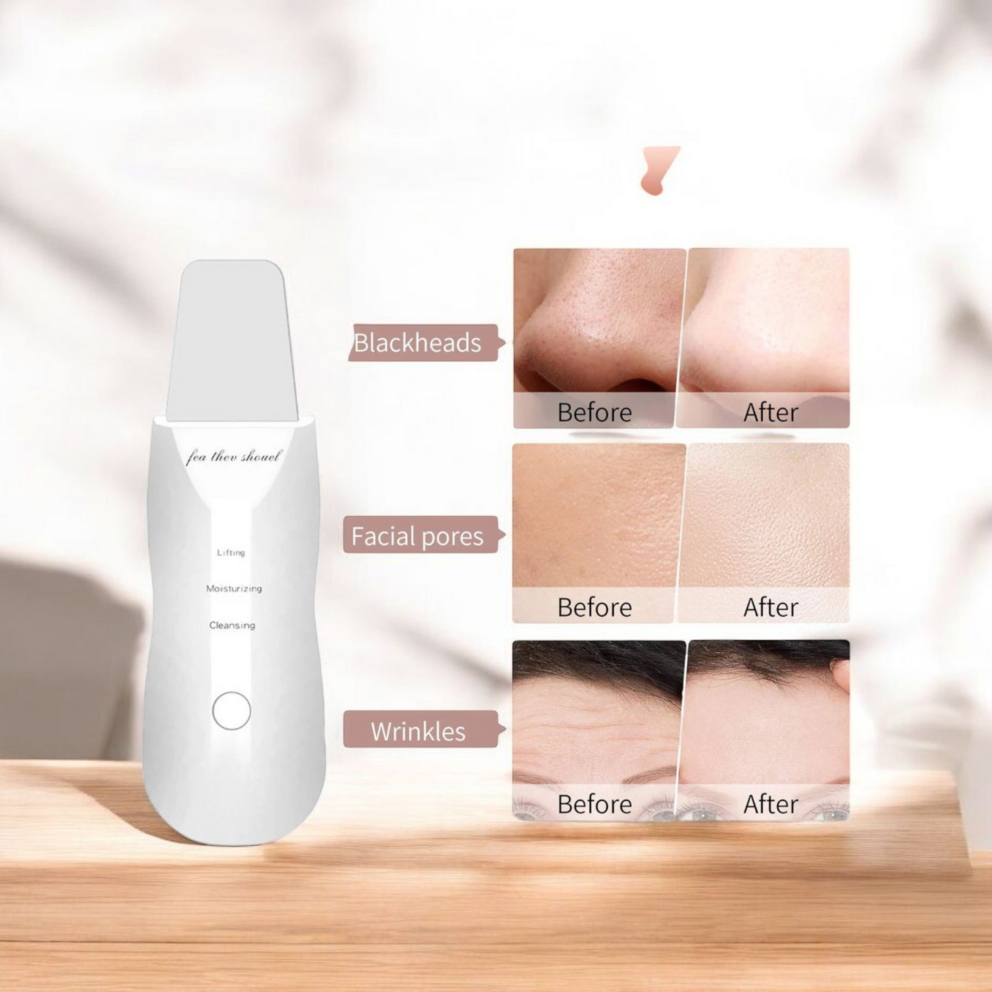 Espátula facial ultrasónica